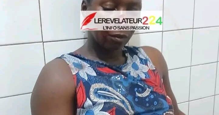 Guinée : Une femme mordue au nez lors d’une dispute familiale img 20260923 wa0003