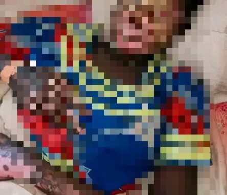 Tchad : Une jeune mère grièvement brûlée par son mari à Komé, l'auteur présumé en fuite img 20260929 085345 912