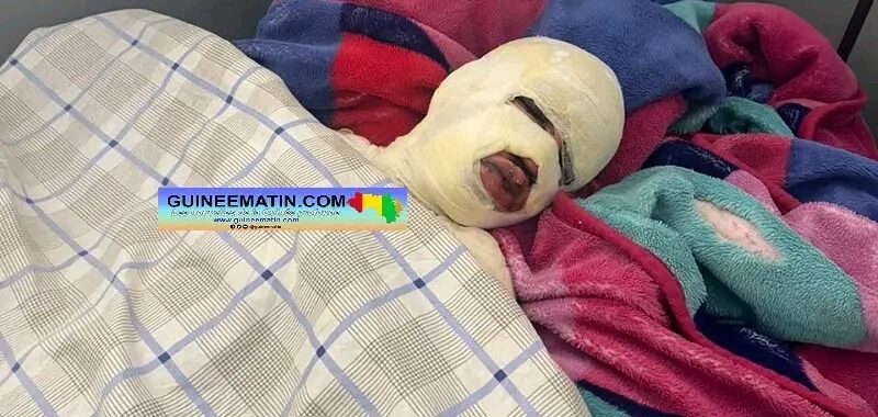 Guinée : Un adolescent de 14 ans grièvement brûlé à Labé : « Kaba a mis volontairement le feu img 20261011 wa0015